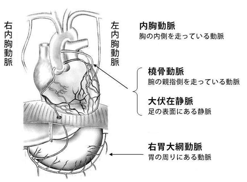 心臓と主要な動脈・静脈の位置関係を示した模式図