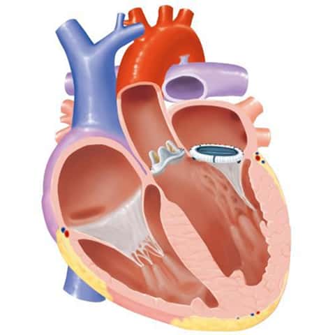 心臓の縦断面図