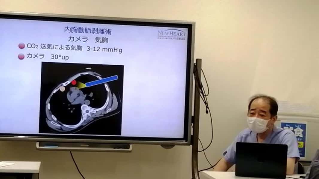 医師による外科手術の技術解説